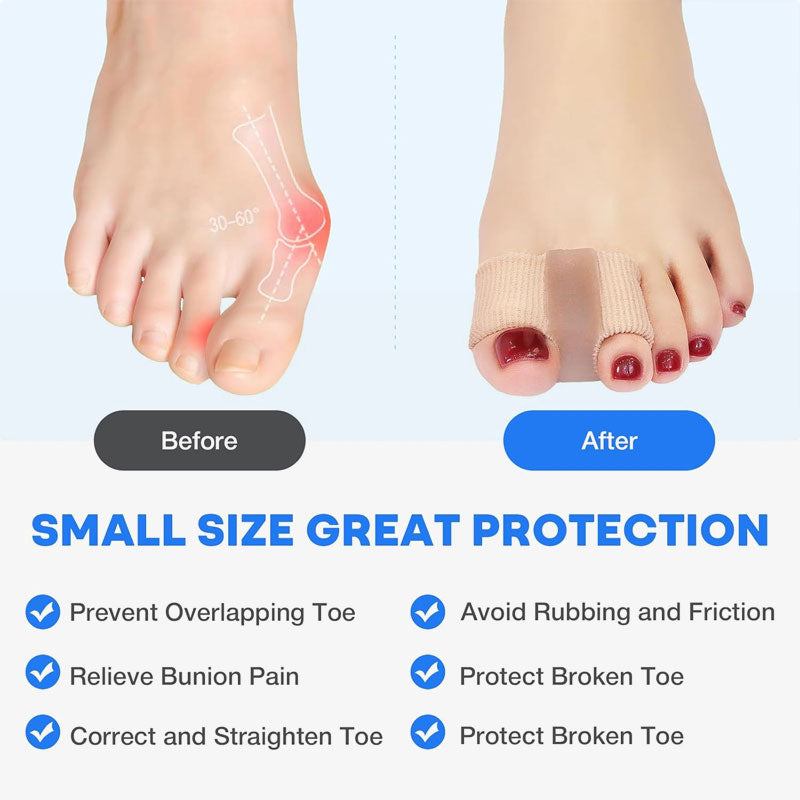 Hallux valgus Entlastung Zehentrenner