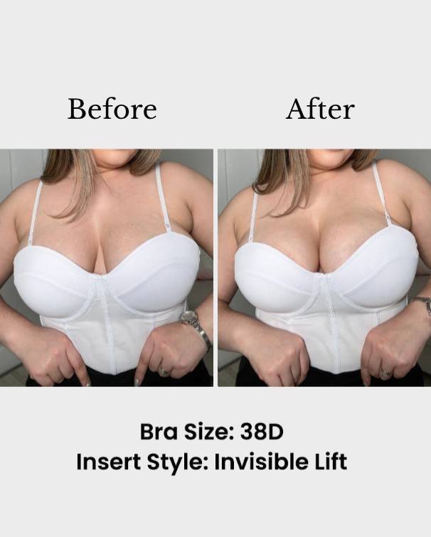 🔥BLITZVERKAUF🔥Unsichtbare Lift-Einlagen | Doppelseitig klebender BH-Lifter für sofortigen Boost