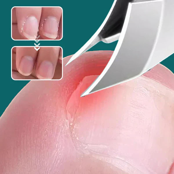 Anti-Slash-Nagelknipser mit schräger Schneide, 3-teiliges Set